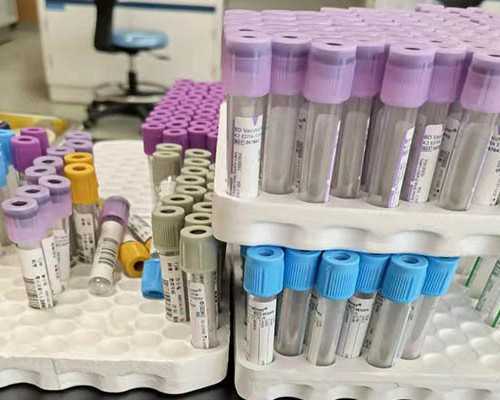 正规权威国内专业试管供卵,试管一般都是双胞胎吗