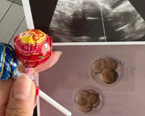 国内代怀孩子男孩,@所有人,你有一份俄罗斯第一代试管婴儿流程攻略待查收!